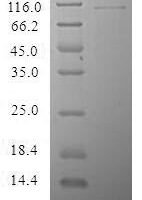 Human Cysteine-rich secretory protein LCCL domain-containing 2 (CRISPLD2) Recombinant Protein, N-MBP/C-His - BioCrest Sci
