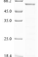 Rabies virus Nucleoprotein (N) Recombinant Protein, C-His - BioCrest Sci