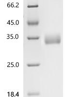 Human CAMPATH-1 antigen (CD52), partial, Biotinylated Recombinant Protein, N-BSA/C-10His-Avi - BioCrest Sci