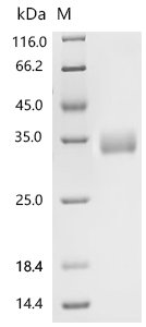 Human CAMPATH-1 antigen (CD52), partial, Biotinylated Recombinant Protein, N-BSA/C-10His-Avi, Homo sapiens (Human), Mammalian cell, N-terminal BSA-tagged and C-terminal 10xHis-Avi-tagged, 27.2 kDa, purity >≥ 95% as determined by SDS-PAGE.