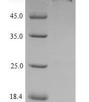 Human Electron transfer flavoprotein-ubiquinone oxidoreductase, mitochondrial (ETFDH) Recombinant Protein, N-His - BioCrest Sci