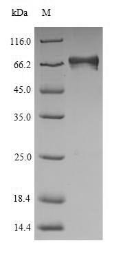 Human Electron transfer flavoprotein-ubiquinone oxidoreductase, mitochondrial (ETFDH) Recombinant Protein, N-His, Homo sapiens (Human), Yeast, N-terminal 6xHis-tagged, 66.7 kDa, purity >≥ 90% as determined by SDS-PAGE.
