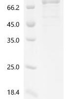 Human Fatty acid CoA ligase Acsl3 (ACSL3), partial Recombinant Protein - BioCrest Sci