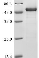 Human Nuclear factor erythroid 2-related factor 2 (NFE2L2), partial Recombinant Protein - BioCrest Sci