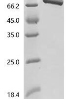 Human Semaphorin-6A (SEMA6A), partial Recombinant Protein - BioCrest Sci