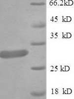 Rat Guanidinoacetate N-methyltransferase (Gamt) Recombinant Protein - BioCrest Sci