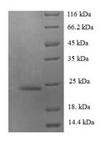 Human C-C motif chemokine 14 (CCL14) Recombinant Protein - BioCrest Sci