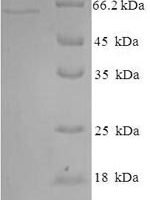 Human Indoleamine 2,3-dioxygenase 2 (IDO2) Recombinant Protein, N-His-SUMO - BioCrest Sci