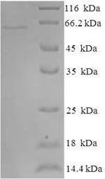 Human Indoleamine 2,3-dioxygenase 2 (IDO2) Recombinant Protein, N-His-SUMO, Homo sapiens (Human), E.coli, N-terminal 6xHis-SUMO-tagged, 61.4 kDa, purity >≥ 90% as determined by SDS-PAGE.