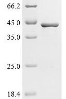 Spirometra erinaceieuropaei Cysteine proteinase Recombinant Protein, C-His - BioCrest Sci