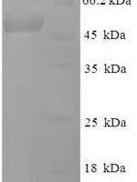 Epstein-Barr virus Deoxyuridine 5'-triphosphate nucleotidohydrolase (BLLF3) Recombinant Protein - BioCrest Sci