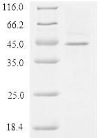 Human Zona pellucida sperm-binding protein 3 (ZP3), partial Recombinant Protein, N-His-Myc - BioCrest Sci