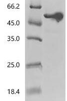 Clostridioides difficile Cell wall-binding cysteine protease Cwp84 (lytC_12) (C116A), partial Recombinant Protein - BioCrest Sci
