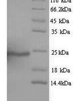 Human Aquaporin-4 (AQP4), partial Recombinant Protein, N-His - BioCrest Sci
