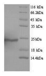 Human Aquaporin-4 (AQP4), partial Recombinant Protein, N-His, Homo sapiens (Human), Yeast, N-terminal 6xHis-tagged, 10.0 kDa, purity >≥ 90% as determined by SDS-PAGE.