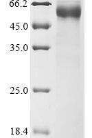 Human Double-stranded RNA-specific adenosine deaminase (ADAR), partial Recombinant Protein, C-hFc1 - BioCrest Sci