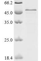 Mouse CD5 antigen-like (Cd5l) Recombinant Protein - BioCrest Sci