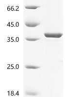 Escherichia coli O6:H1 DNA-binding dual transcriptional regulator OmpR (ompR) Recombinant Protein, N-His/C-His - BioCrest Sci