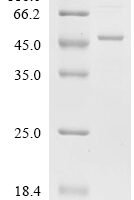 Human Guanine nucleotide-binding protein G(i) subunit alpha-2 (GNAI2) Recombinant Protein - BioCrest Sci