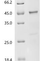 Human Heme-binding protein 1 (HEBP1) Recombinant Protein - BioCrest Sci