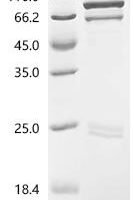 Human Disintegrin and metalloproteinase domain-containing protein 10 (ADAM10), partial Recombinant Protein - BioCrest Sci