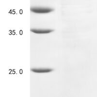 Human Ras GTPase-activating protein-binding protein 1 (G3BP1) Recombinant Protein - BioCrest Sci