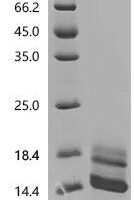 Human Seizure protein 6 homolog (SEZ6), partial Recombinant Protein, C-10His, aa 833–925 - BioCrest Sci