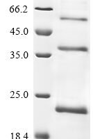 Human Atrial natriuretic peptide-converting enzyme (CORIN), partial Recombinant Protein, N-His, aa 1–110 - BioCrest Sci