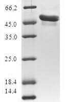 Human Amino-terminal enhancer of split (AES) Recombinant Protein - BioCrest Sci
