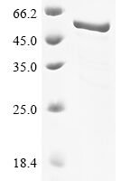 Canine coronavirus Nucleoprotein (N) Recombinant Protein, N-His, aa 1–382 - BioCrest Sci