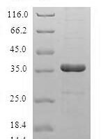 Human Ragulator complex protein LAMTOR5(LAMTOR5) Recombinant Protein - BioCrest Sci