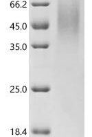 Mycolicibacterium smegmatis 3-oxosteroid 1-dehydrogenase (ksdD) Recombinant Protein, C-His, aa 1–569, Purity ≥85% - BioCrest Sci