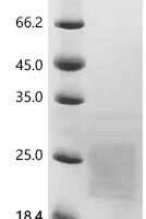 Human Tumor necrosis factor receptor superfamily member 13B (TNFRSF13B), partial Recombinant Protein - BioCrest Sci