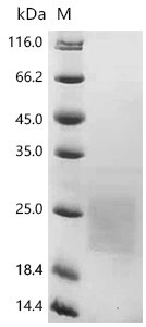 Human Tumor necrosis factor receptor superfamily member 13B (TNFRSF13B), partial Recombinant Protein, Homo sapiens (Human), Mammalian cell, C-terminal 10xHis-tagged, 19.9 kDa, purity >≥ 95% as determined by SDS-PAGE.