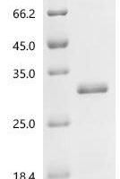 Escherichia phage MS2 Capsid protein Recombinant Protein, N-His-SUMO - BioCrest Sci
