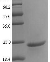 Carpinus betulus Major pollen allergen Car b 1 isoform 2 Recombinant Protein - BioCrest Sci
