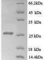 Human Myelin transcription factor 1 (MYT1), partial Recombinant Protein, N-His - BioCrest Sci
