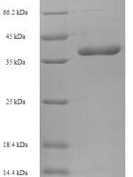 Human Bcl-2-like protein 11 (BCL2L11) Recombinant Protein, N-His-SUMO - BioCrest Sci