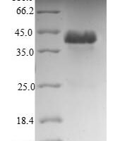 Human NADH dehydrogenase [ubiquinone] 1 alpha subcomplex subunit 12 (NDUFA12) Recombinant Protein - BioCrest Sci