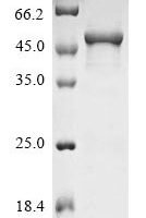 Human Secretogranin-2 (SCG2), partial Recombinant Protein - BioCrest Sci