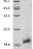 Mouse Ly-6/neurotoxin-like protein 1 (Lynx1) Recombinant Protein, C-His, aa 21–131 - BioCrest Sci