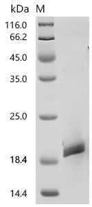 Mouse Ly-6/neurotoxin-like protein 1 (Lynx1) Recombinant Protein, C-His, aa 21–131, Mus musculus (Mouse), E.coli, C-terminal 6xHis-tagged, 18.8 kDa, purity >≥ 90% as determined by SDS-PAGE.≥ 95% as determined by SEC-HPLC.