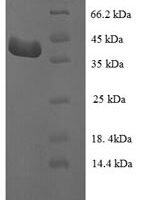 Human Leucine-rich repeat flightless-interacting protein 1 (LRRFIP1), partial Recombinant Protein - BioCrest Sci