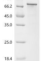Rat Long-chain-fatty-acid--CoA ligase 4 (Acsl4) Recombinant Protein - BioCrest Sci
