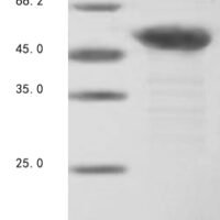Bovine Troponin T, fast skeletal muscle (Tnnt3) Recombinant Protein, N-10His/C-Myc, aa 2–271, E.coli - BioCrest Sci