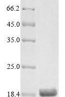 Rat Artemin (Artn) Recombinant Protein - BioCrest Sci