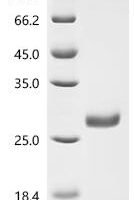 Thermotoga neapolitana Endonuclease V (nfi) Recombinant Protein, C-His - BioCrest Sci