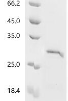 Atrax robustus Delta-hexatoxin-Ar1a Recombinant Protein, N-GST - BioCrest Sci