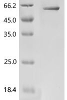 Mouse Angiopoietin-2 (Angpt2) Recombinant Protein - BioCrest Sci