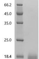 Human Seizure protein 6 homolog (SEZ6), partial Recombinant Protein, C-10His, aa 705–767 - BioCrest Sci